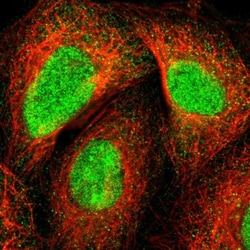 ZNF589 Antibody, Novus Biologicals:Antibodies:Primary Antibodies
